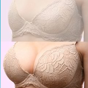 Breast 4+, effetti collaterali, controindicazioni